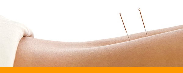 Acupuncture at the Kinesis Center