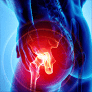 hip pain1